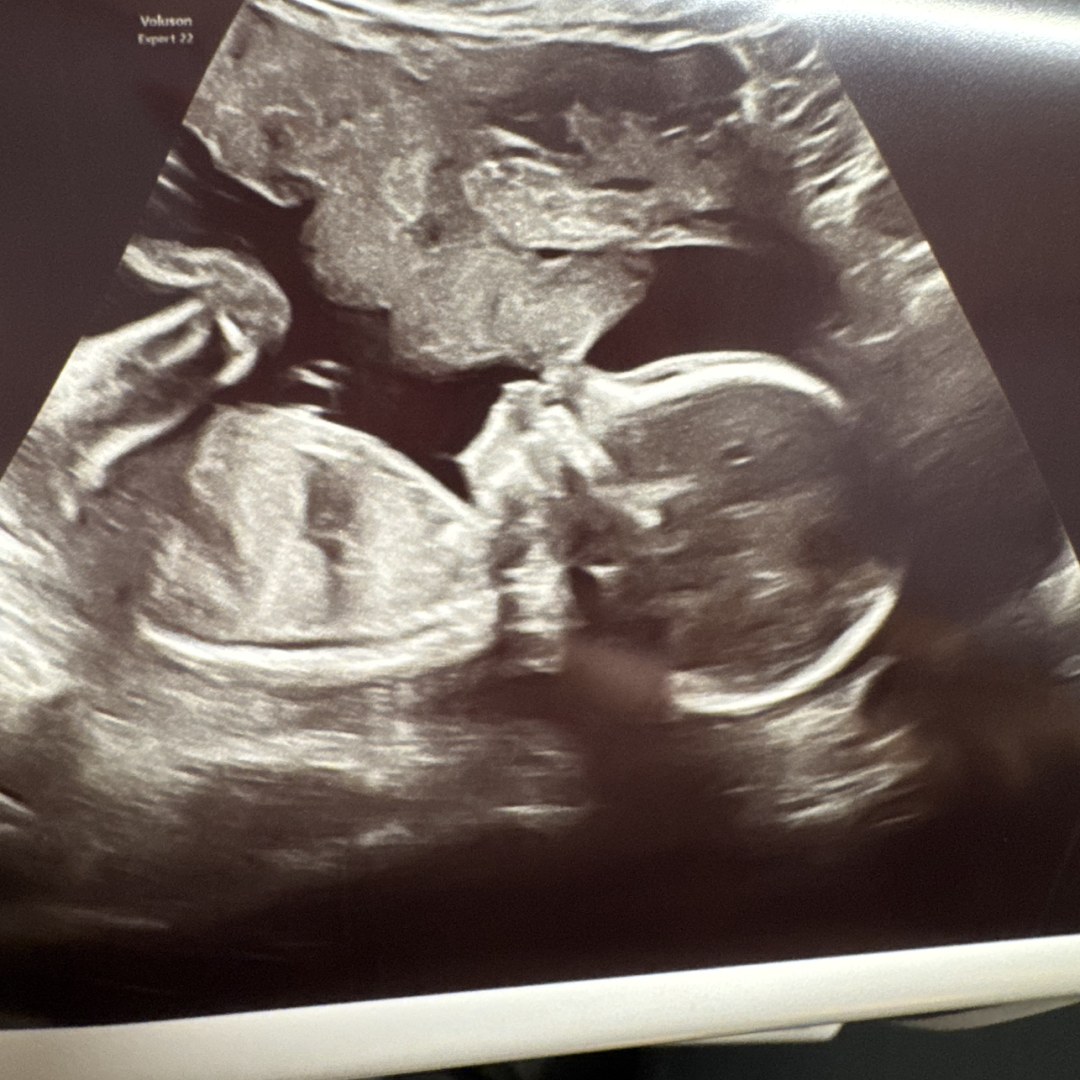 Photo shared by Jessica for their Babylist baby registry.