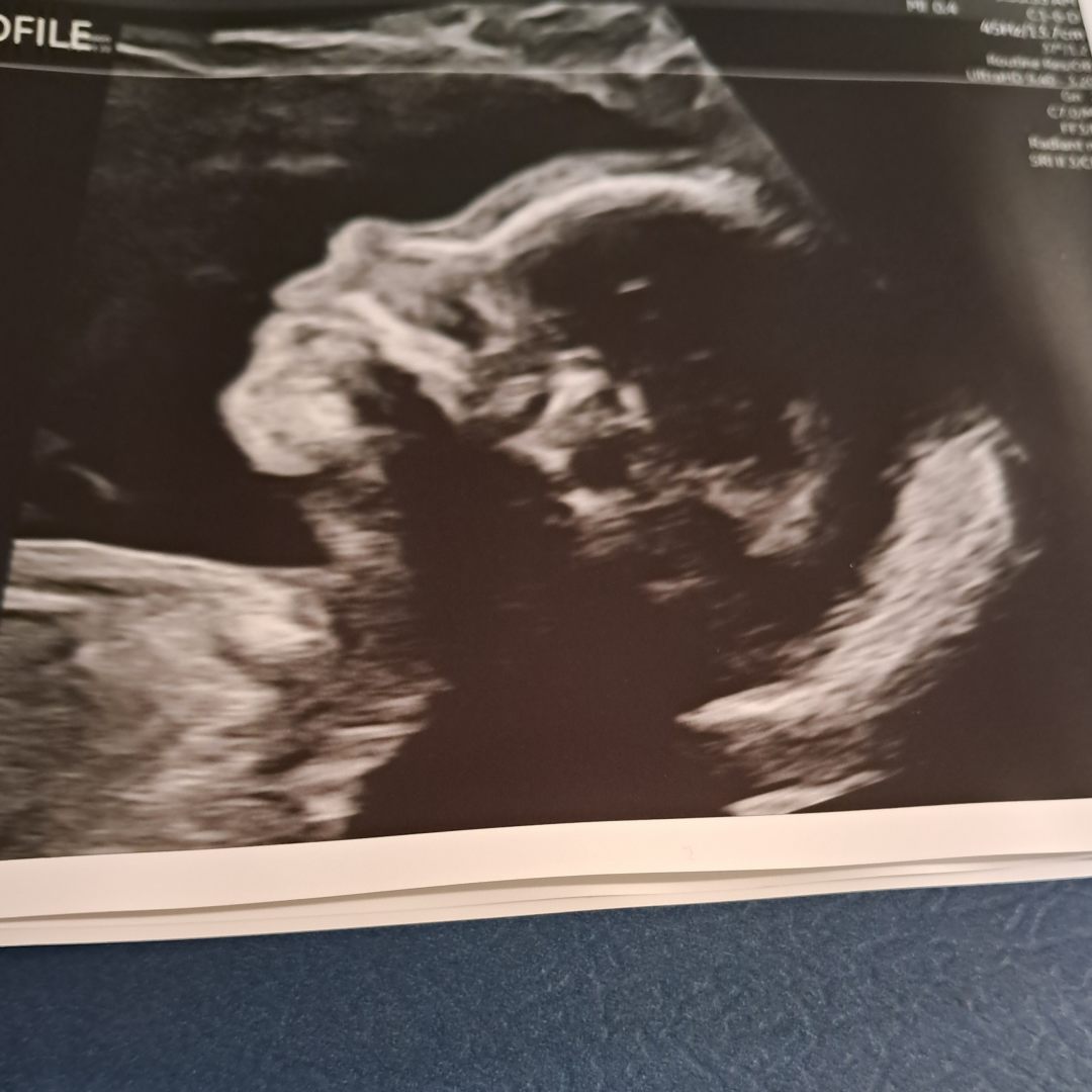 Photo shared by Samantha for their Babylist baby registry.