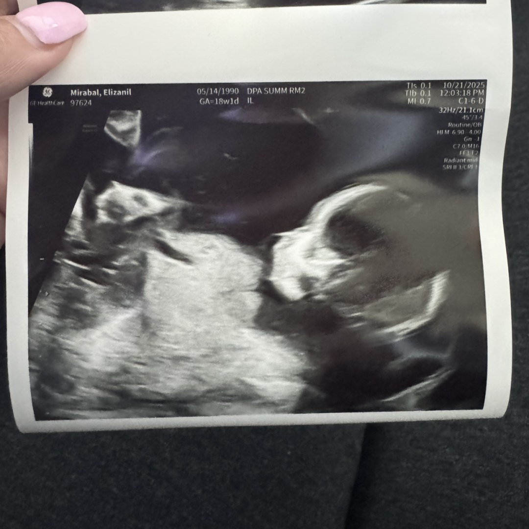 Photo shared by Elizanil for their Babylist baby registry.