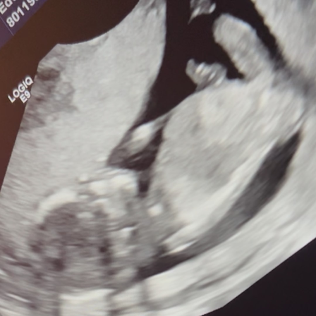 Photo shared by Tameia for their Babylist baby registry.