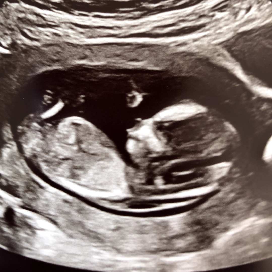 Photo shared by Maude Mc for their Babylist baby registry.