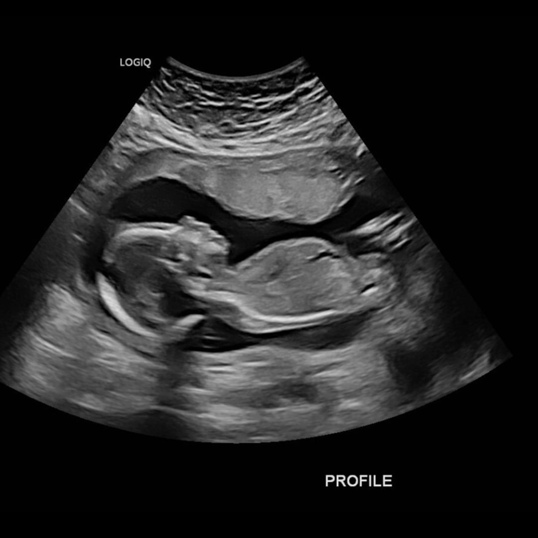 Photo shared by Kryslyn for their Babylist baby registry.