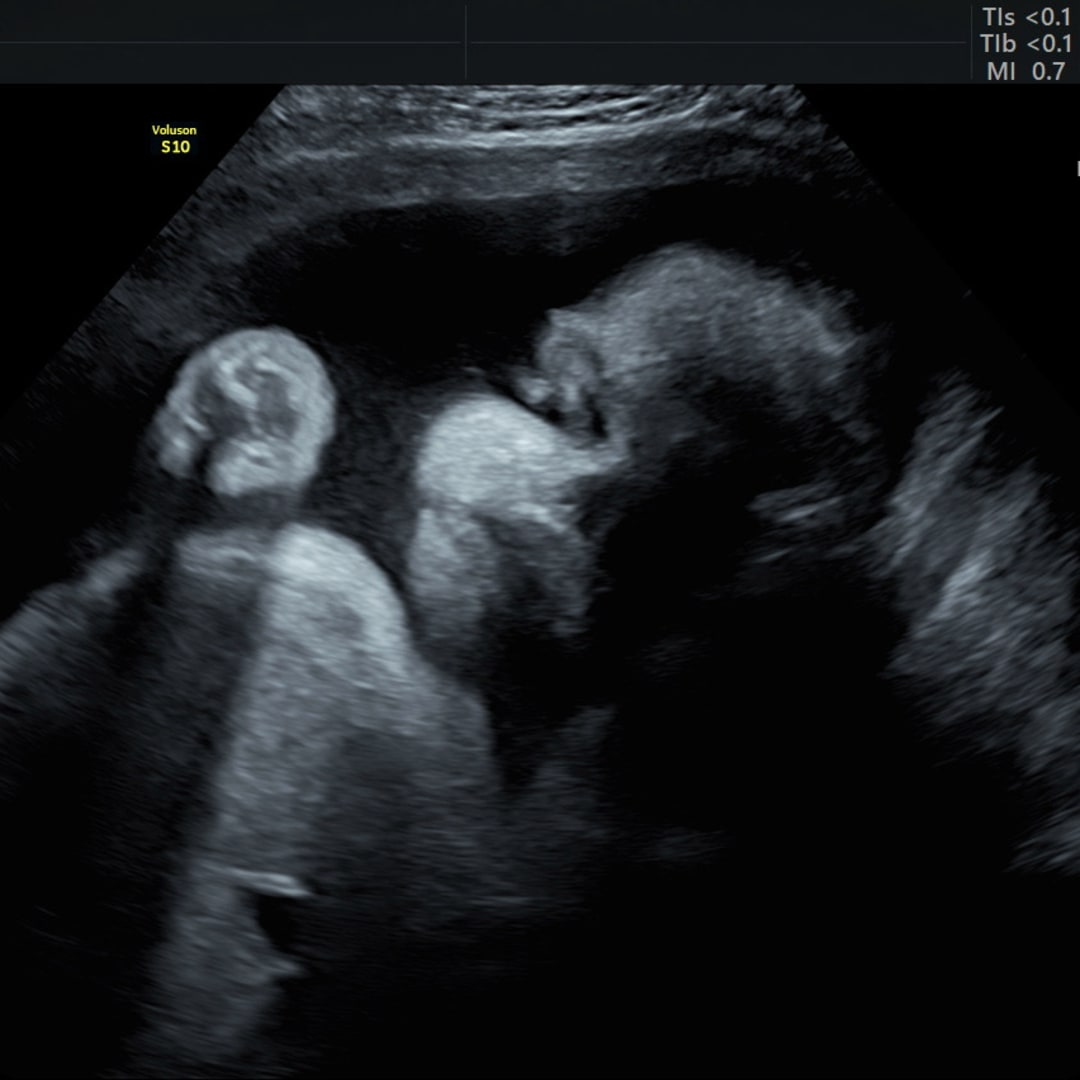 Photo shared by Kristine for their Babylist baby registry.