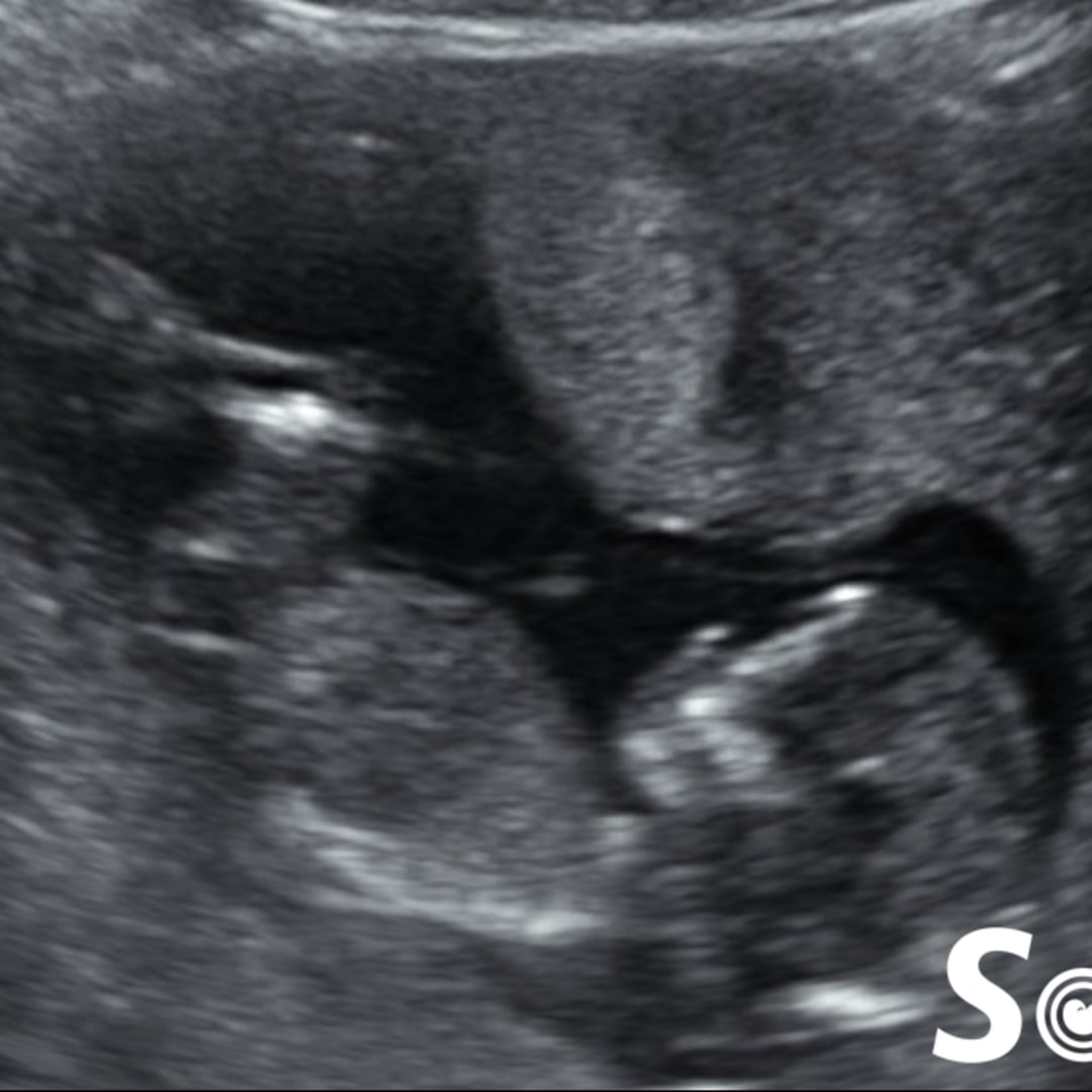 Photo shared by Jalynne for their Babylist baby registry.