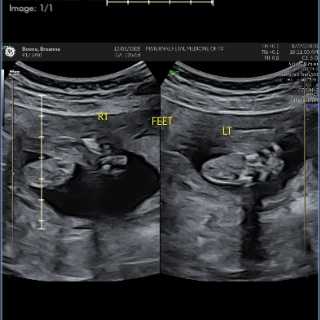 Photo shared by Breanna for their Babylist baby registry.