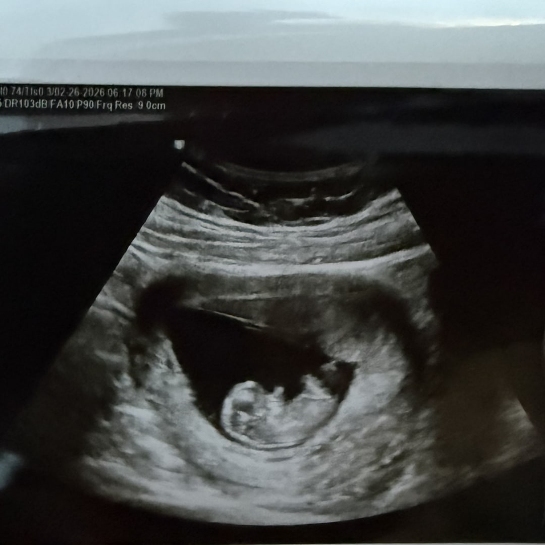 Photo shared by Julian for their Babylist baby registry.