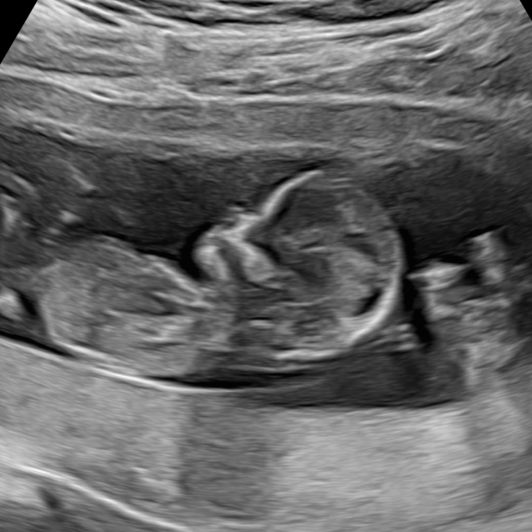 Photo shared by Abigail for their Babylist baby registry.