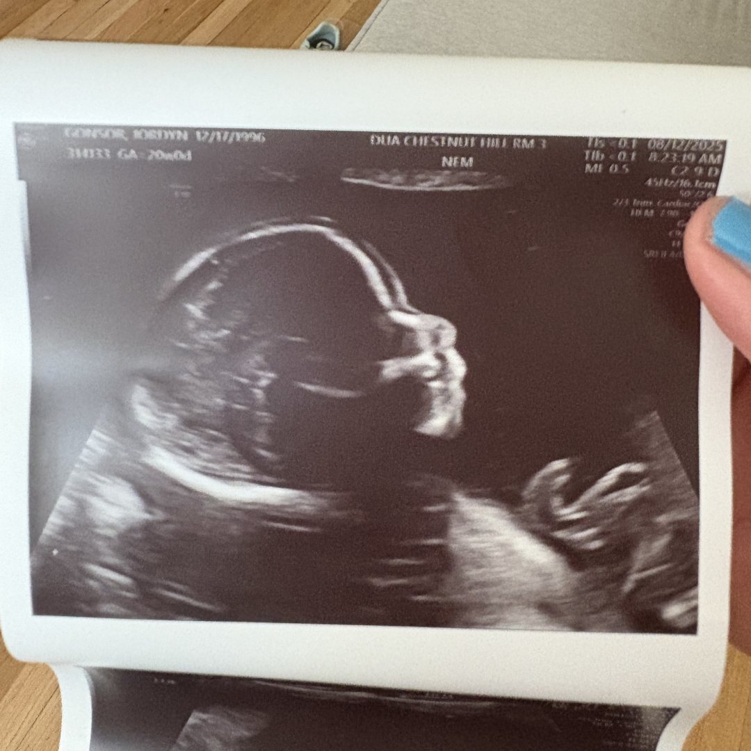 Photo shared by Jordyn for their Babylist baby registry.