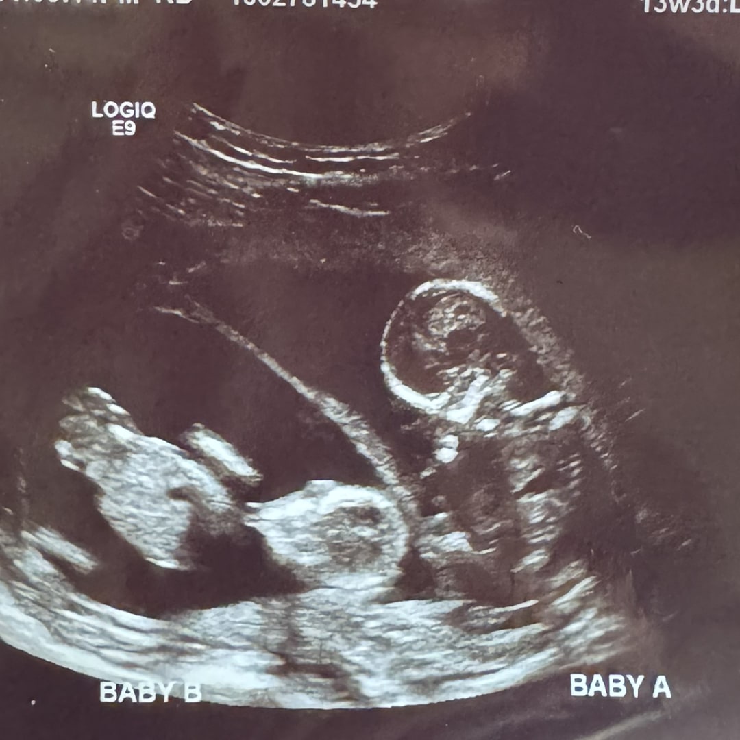 Photo shared by Sahale for their Babylist baby registry.