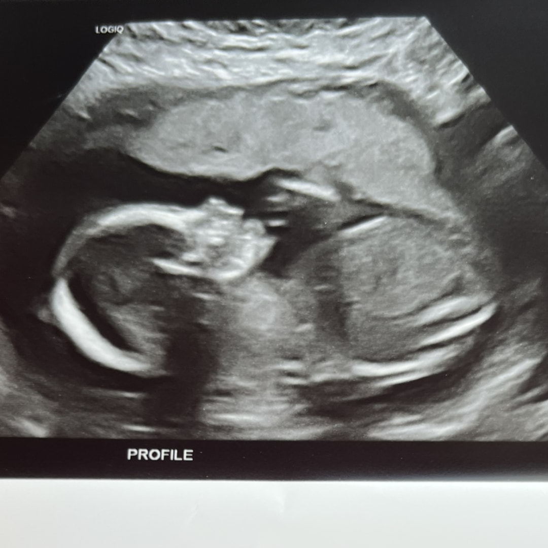 Photo shared by Francisca for their Babylist baby registry.