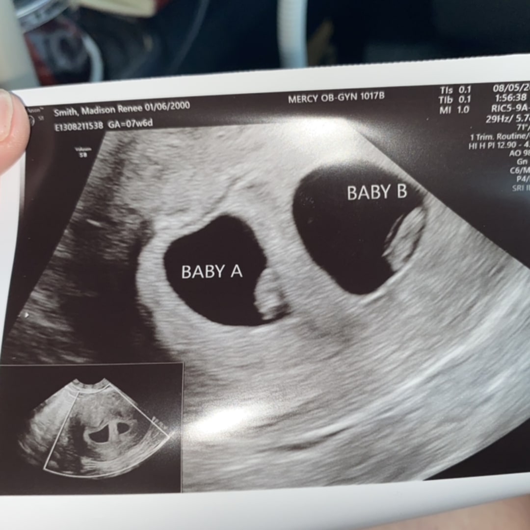 Photo shared by Madison for their Babylist baby registry.