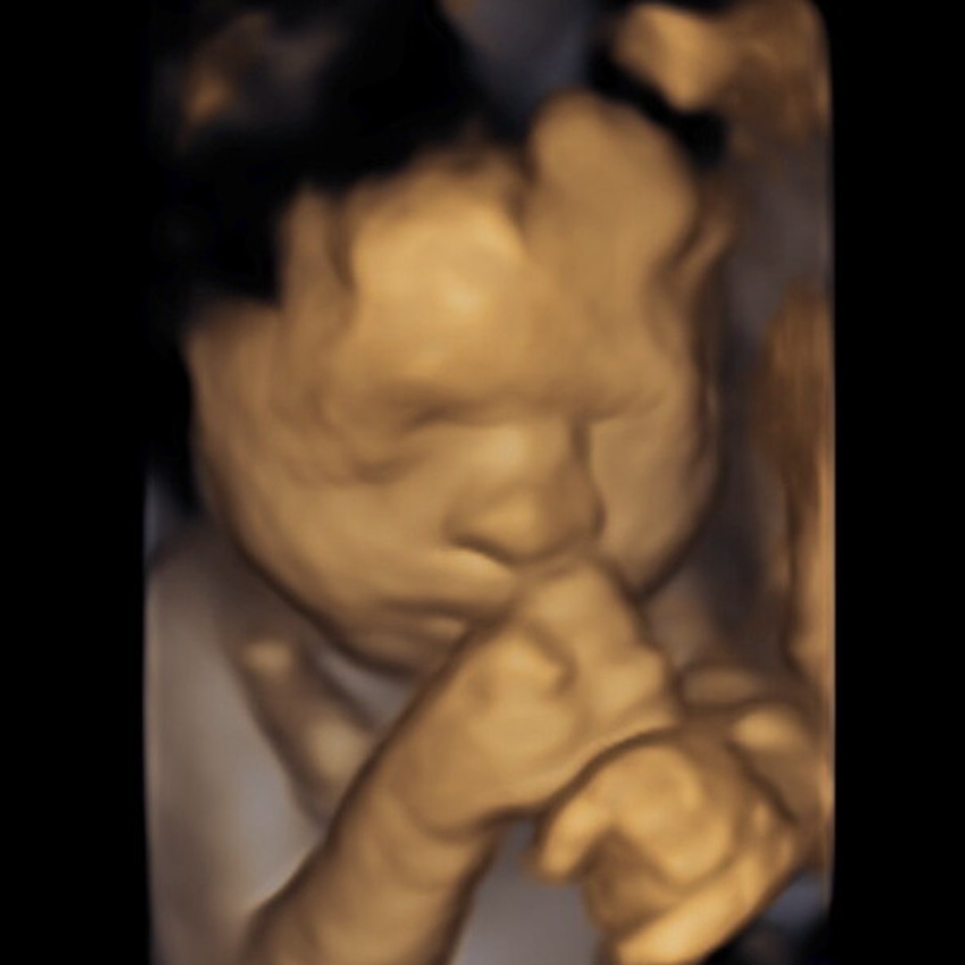 Photo shared by Angela for their Babylist baby registry.
