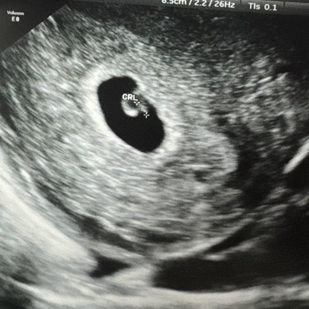 Photo shared by Erin for their Babylist baby registry.