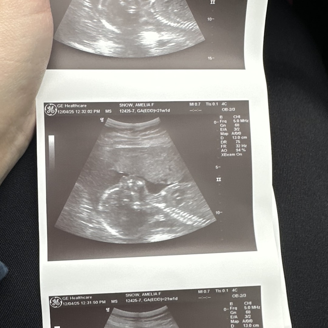 Photo shared by Amelia for their Babylist baby registry.