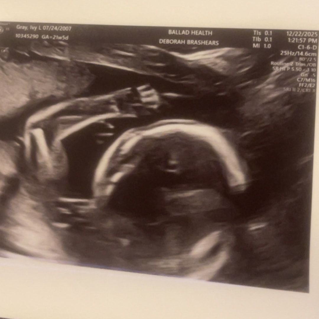 Photo shared by Ivy for their Babylist baby registry.