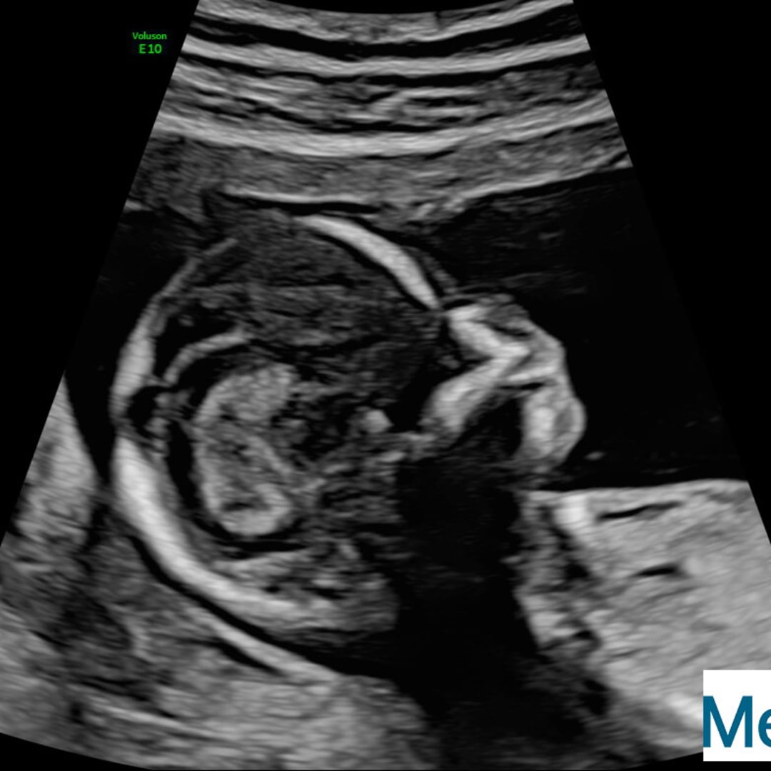 Photo shared by Deanne for their Babylist baby registry.