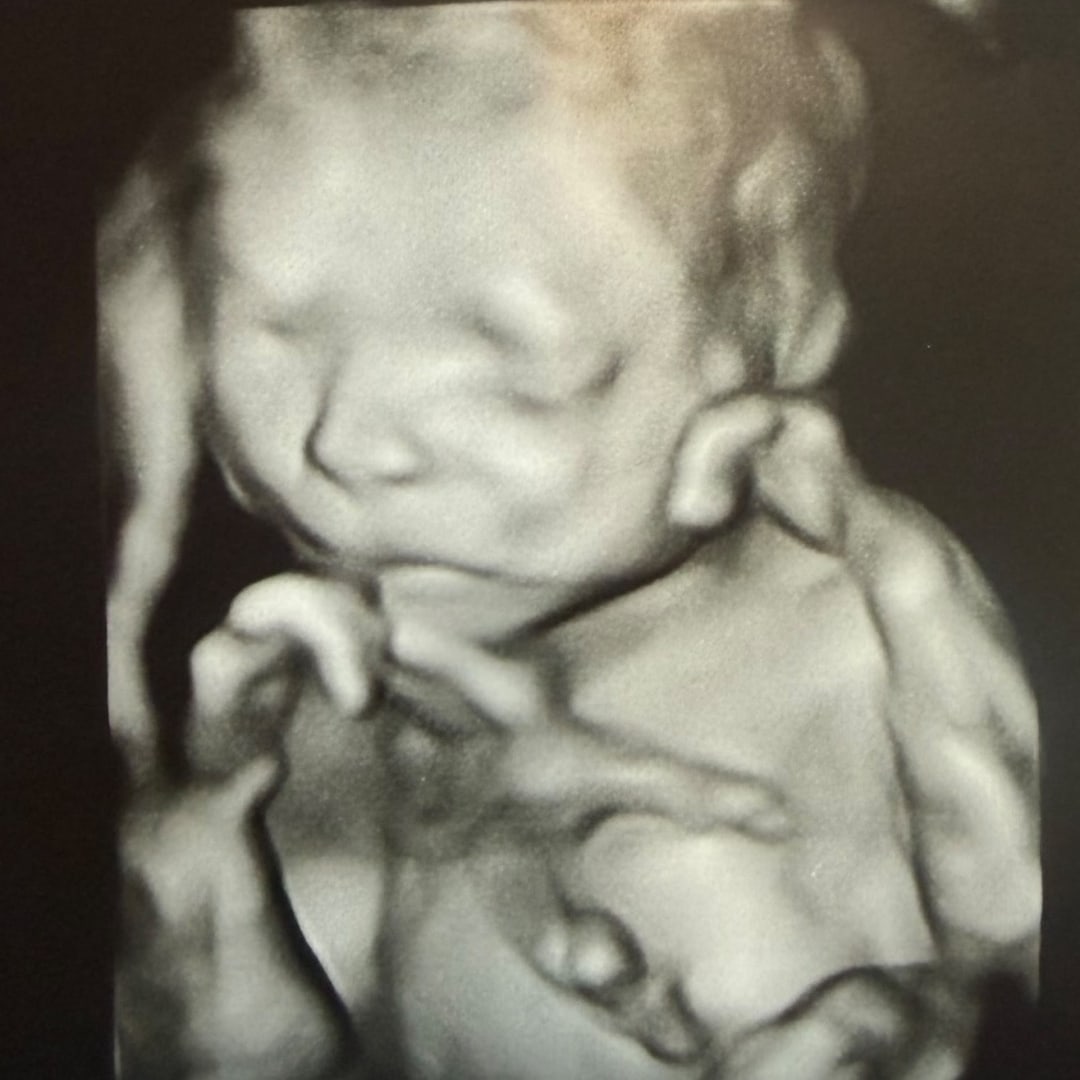 Photo shared by Brenda for their Babylist baby registry.