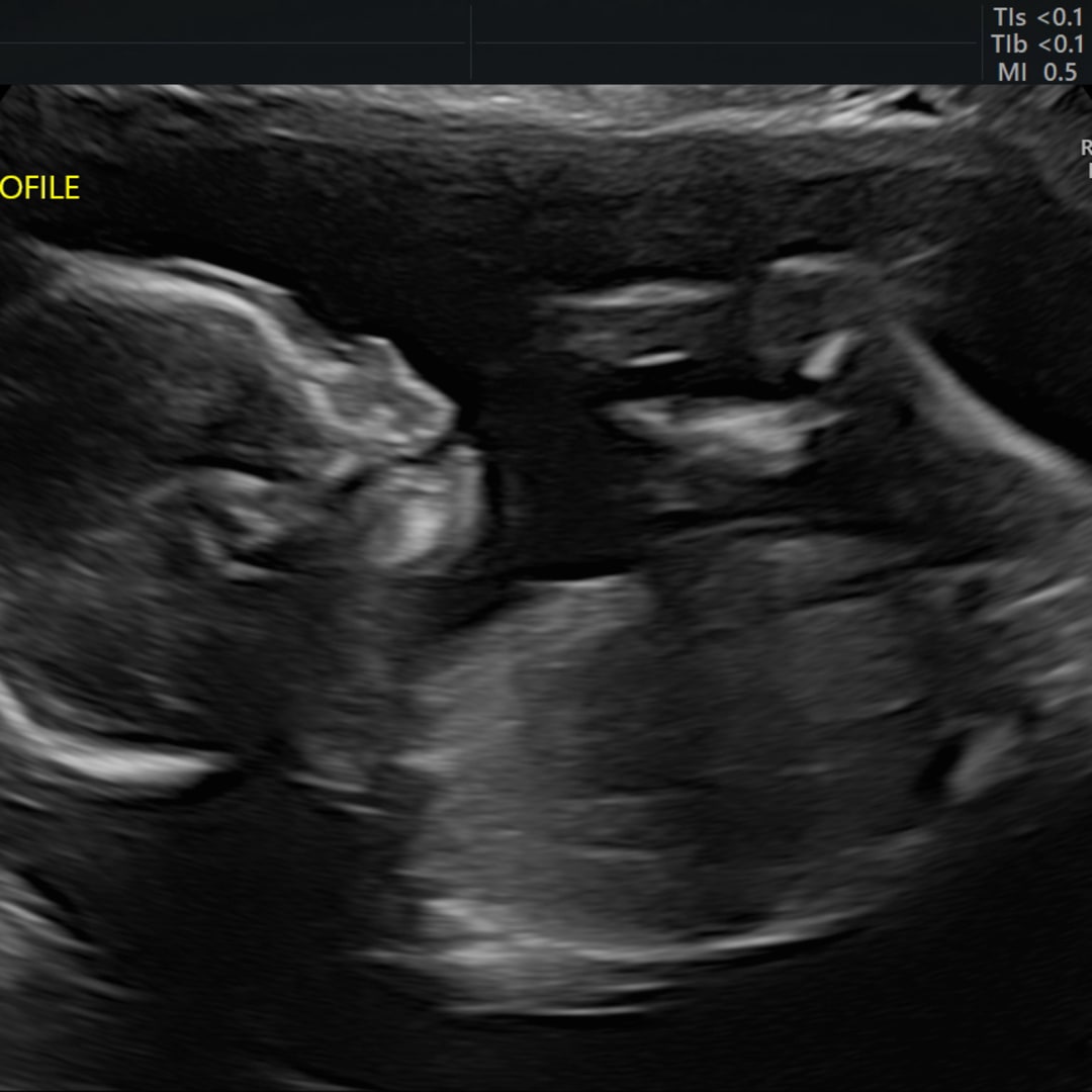 Photo shared by Kierstyn for their Babylist baby registry.
