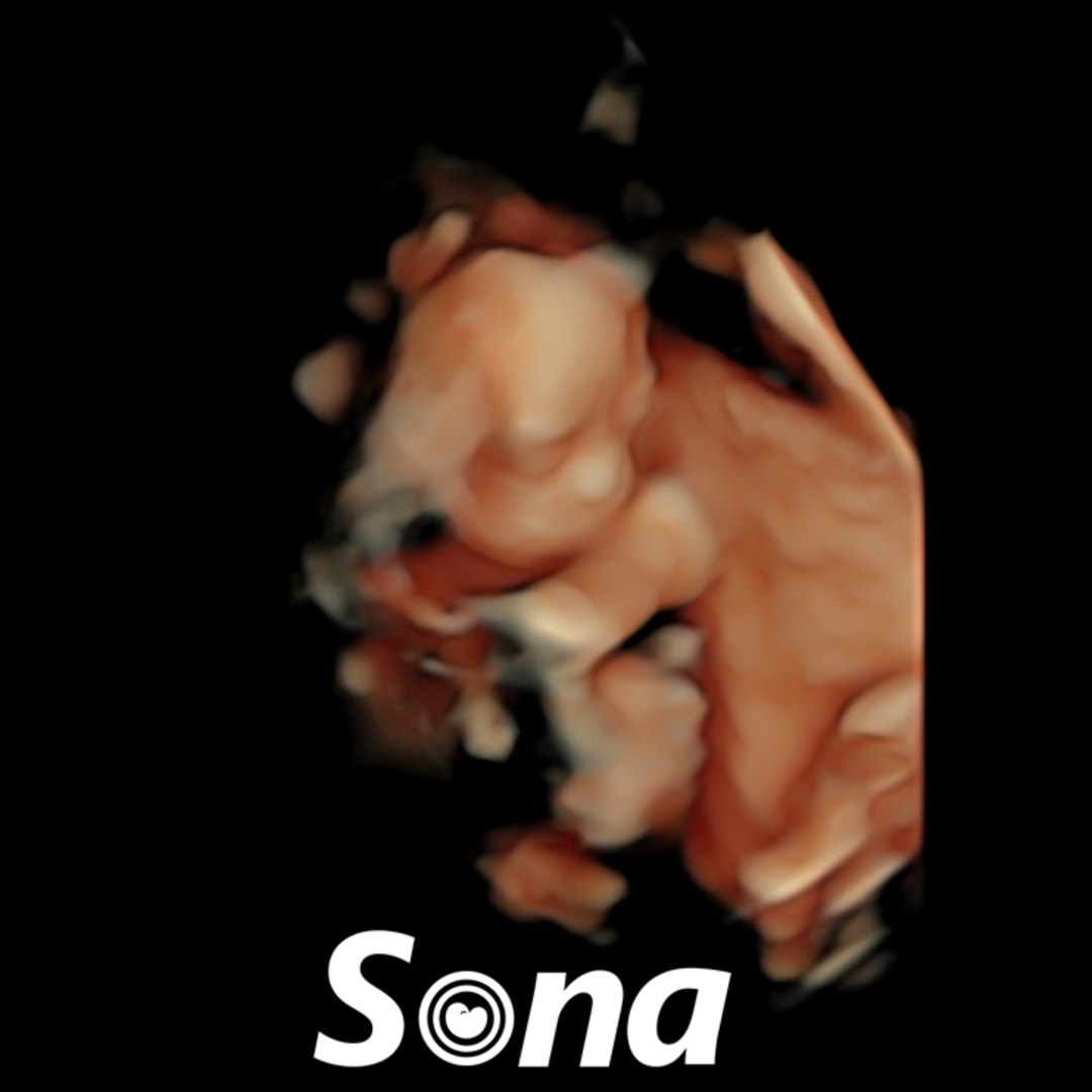 Photo shared by Ashley for their Babylist baby registry.