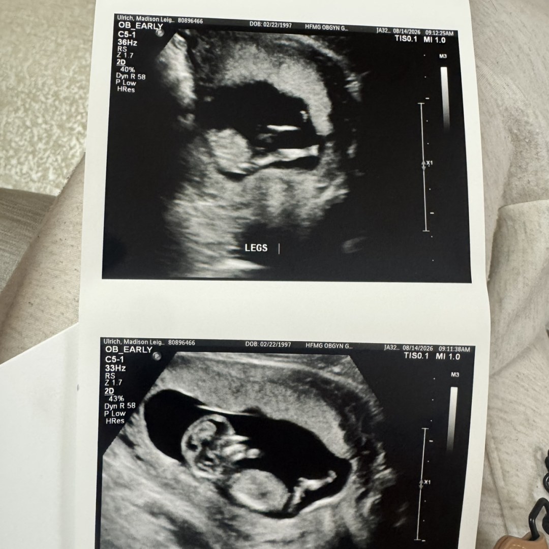 Photo shared by Madison for their Babylist baby registry.