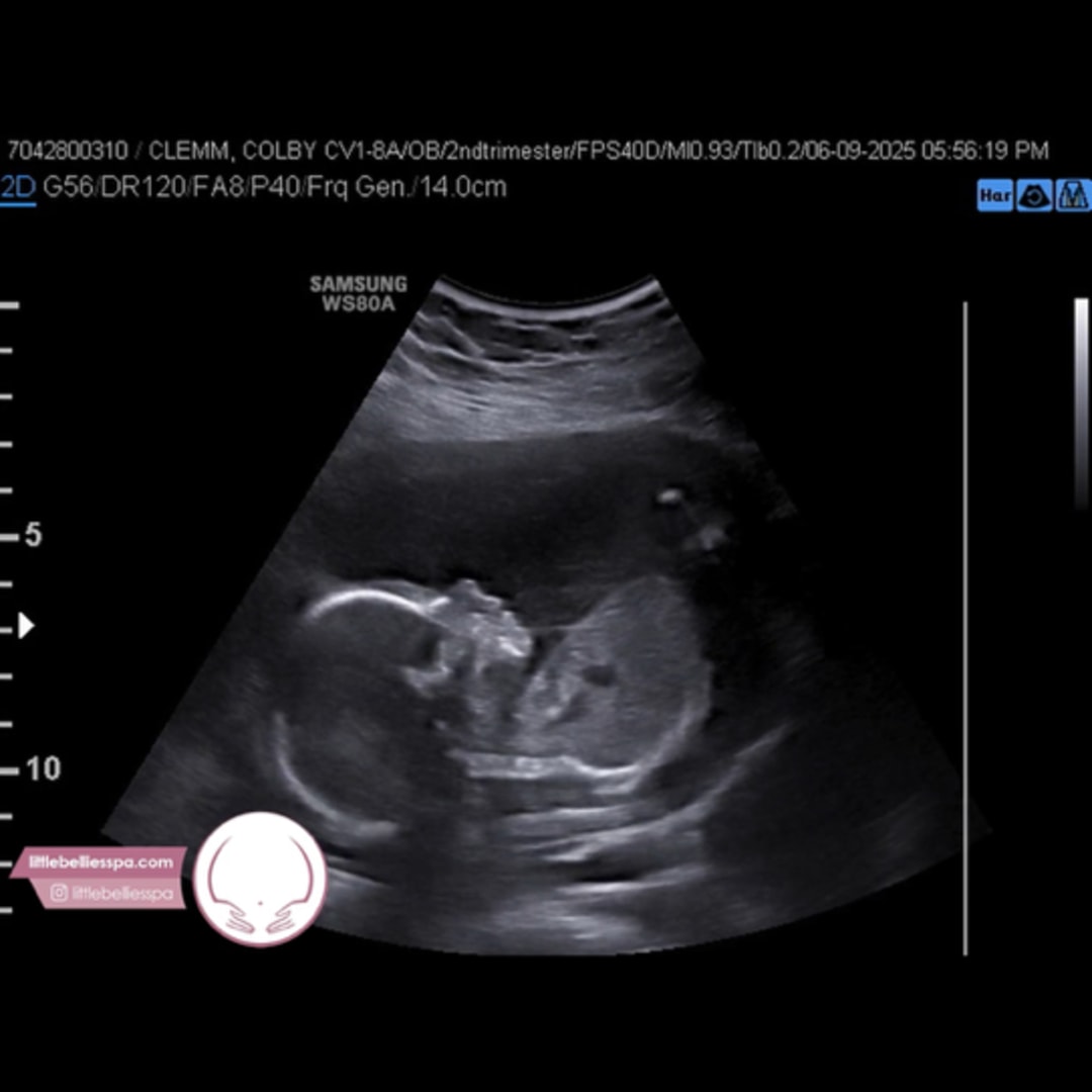 Photo shared by Colby for their Babylist baby registry.