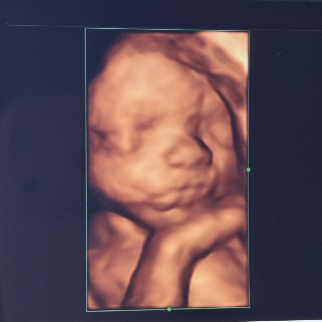 Photo shared by Kelsey for their Babylist baby registry.