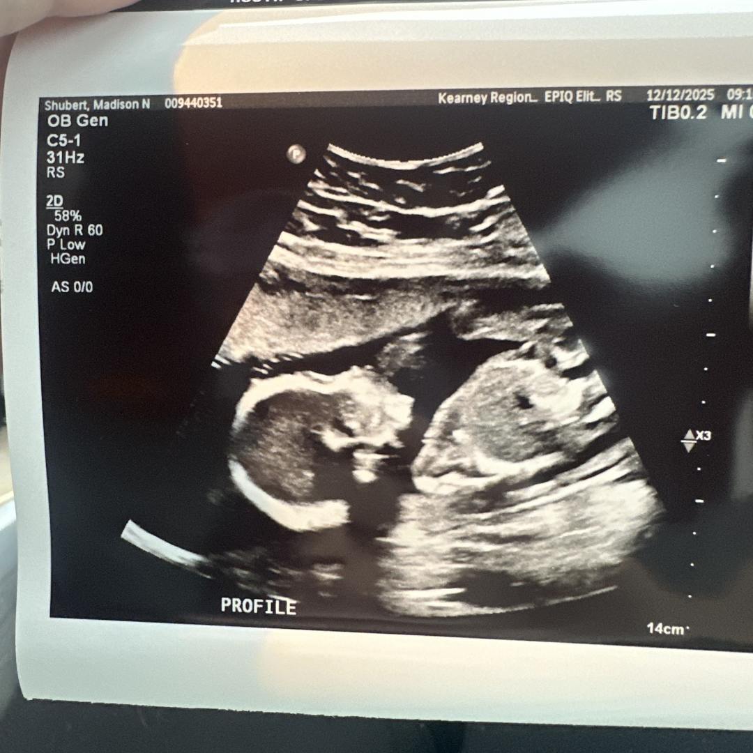 Photo shared by Madison for their Babylist baby registry.