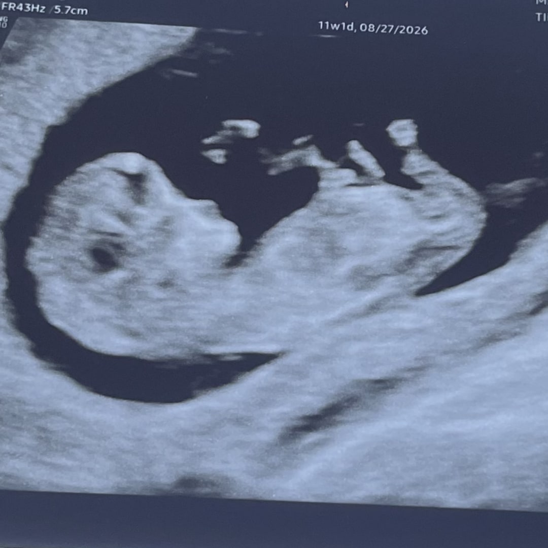 Photo shared by Taylor for their Babylist baby registry.