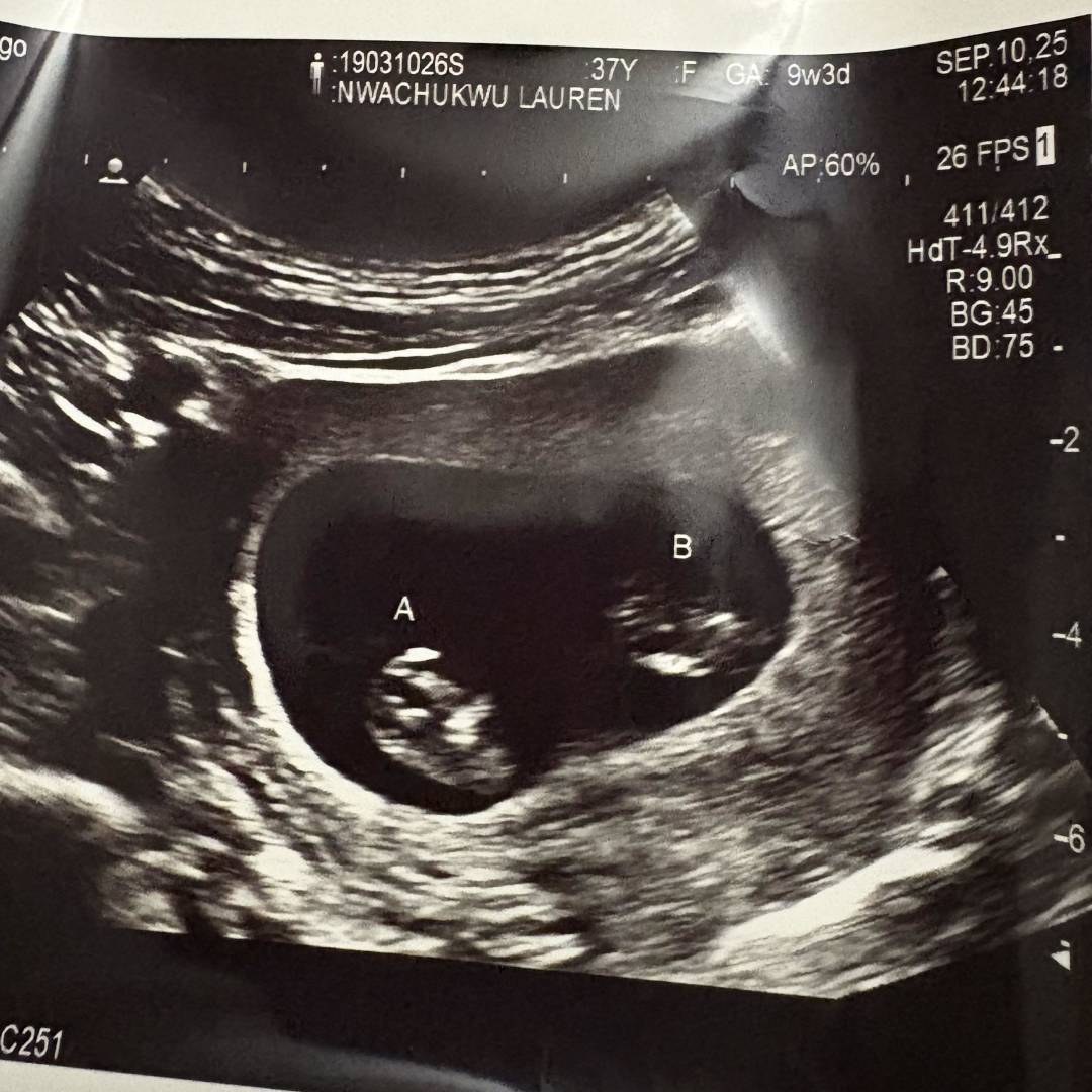 Photo shared by Lauren for their Babylist baby registry.