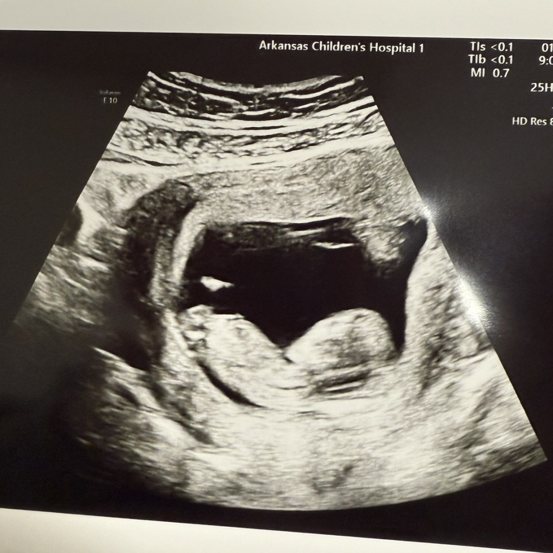 Photo shared by Shelbie for their Babylist baby registry.