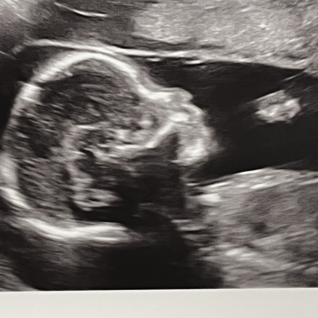 Photo shared by Sandra for their Babylist baby registry.