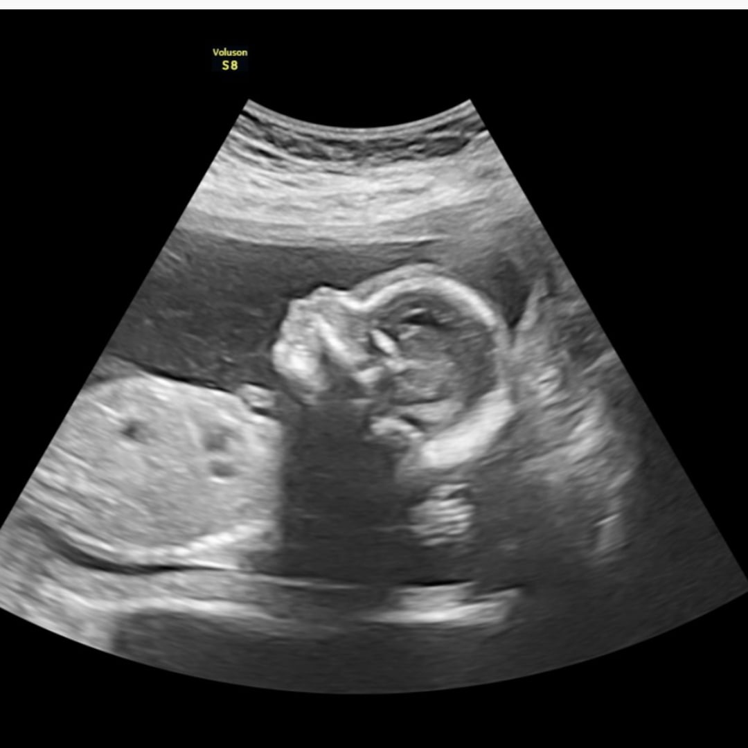 Photo shared by Daniel for their Babylist baby registry.