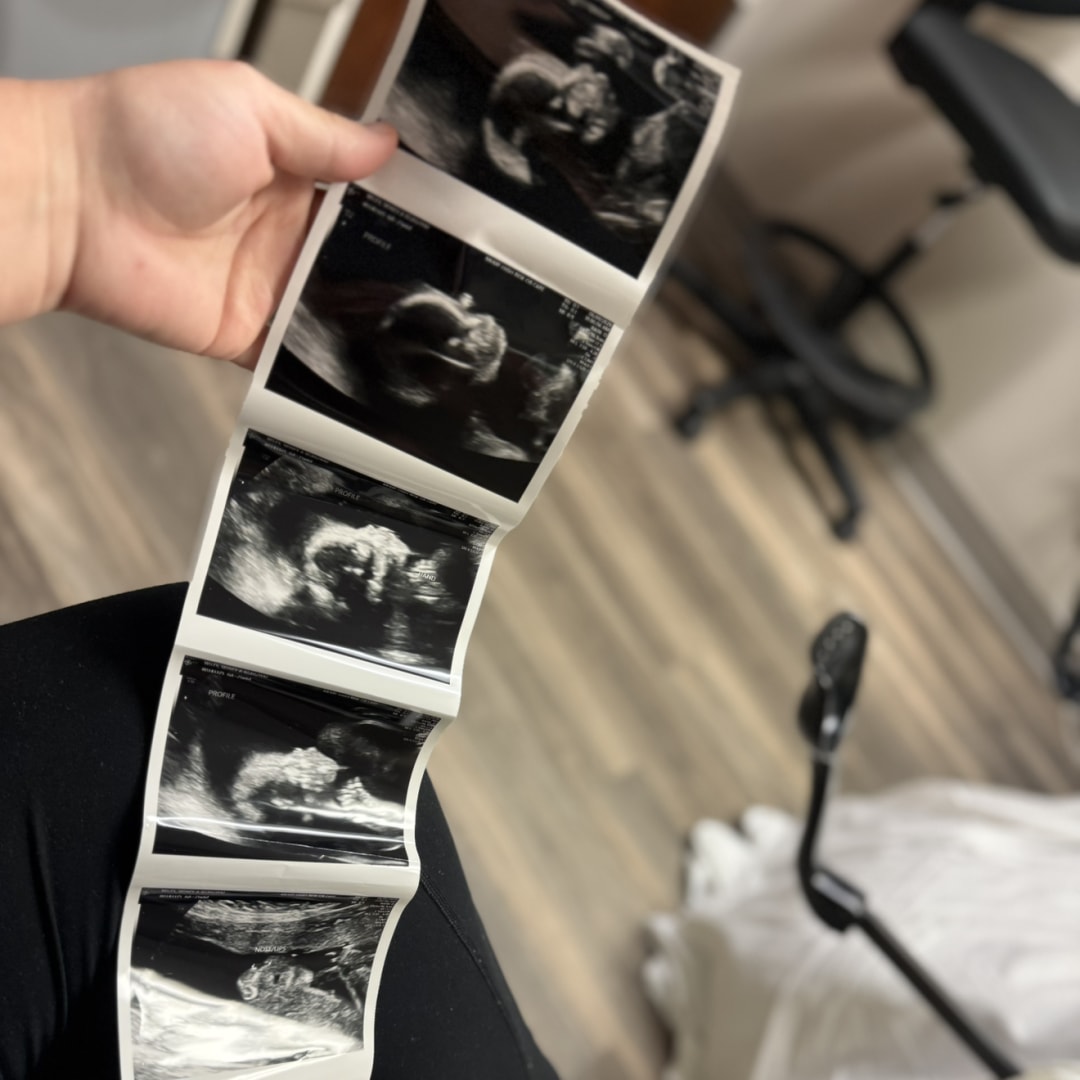 Photo shared by Sidney for their Babylist baby registry.