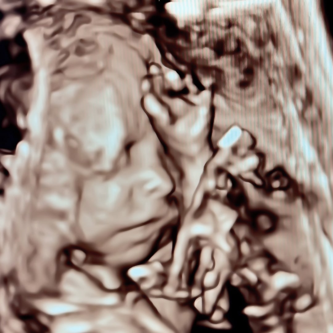Photo shared by Brooke for their Babylist baby registry.