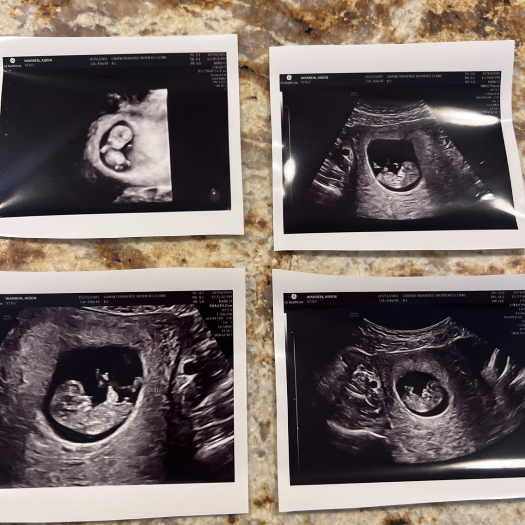Photo shared by Aiden for their Babylist baby registry.