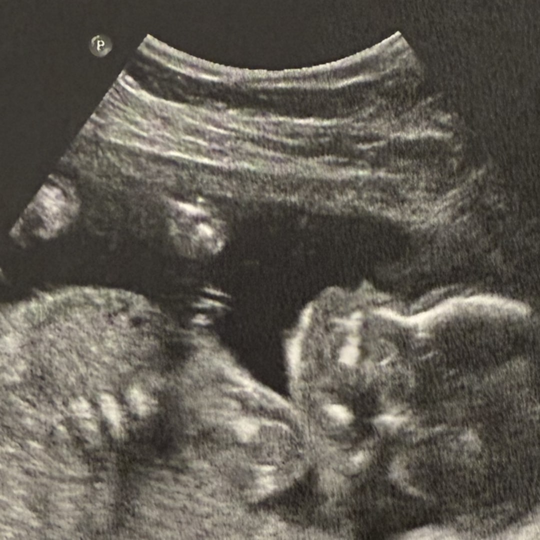 Photo shared by Maryann for their Babylist baby registry.