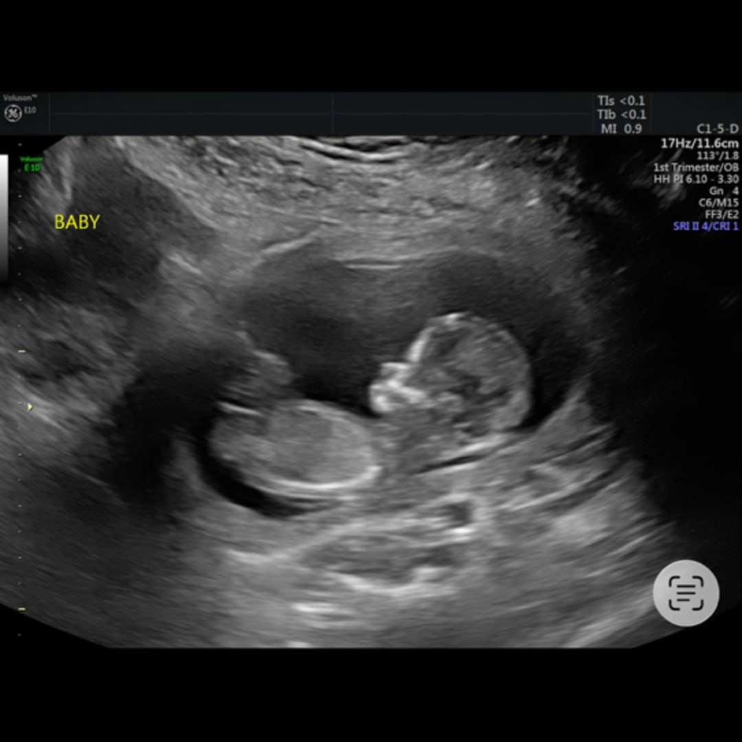 Photo shared by Kenzie for their Babylist baby registry.