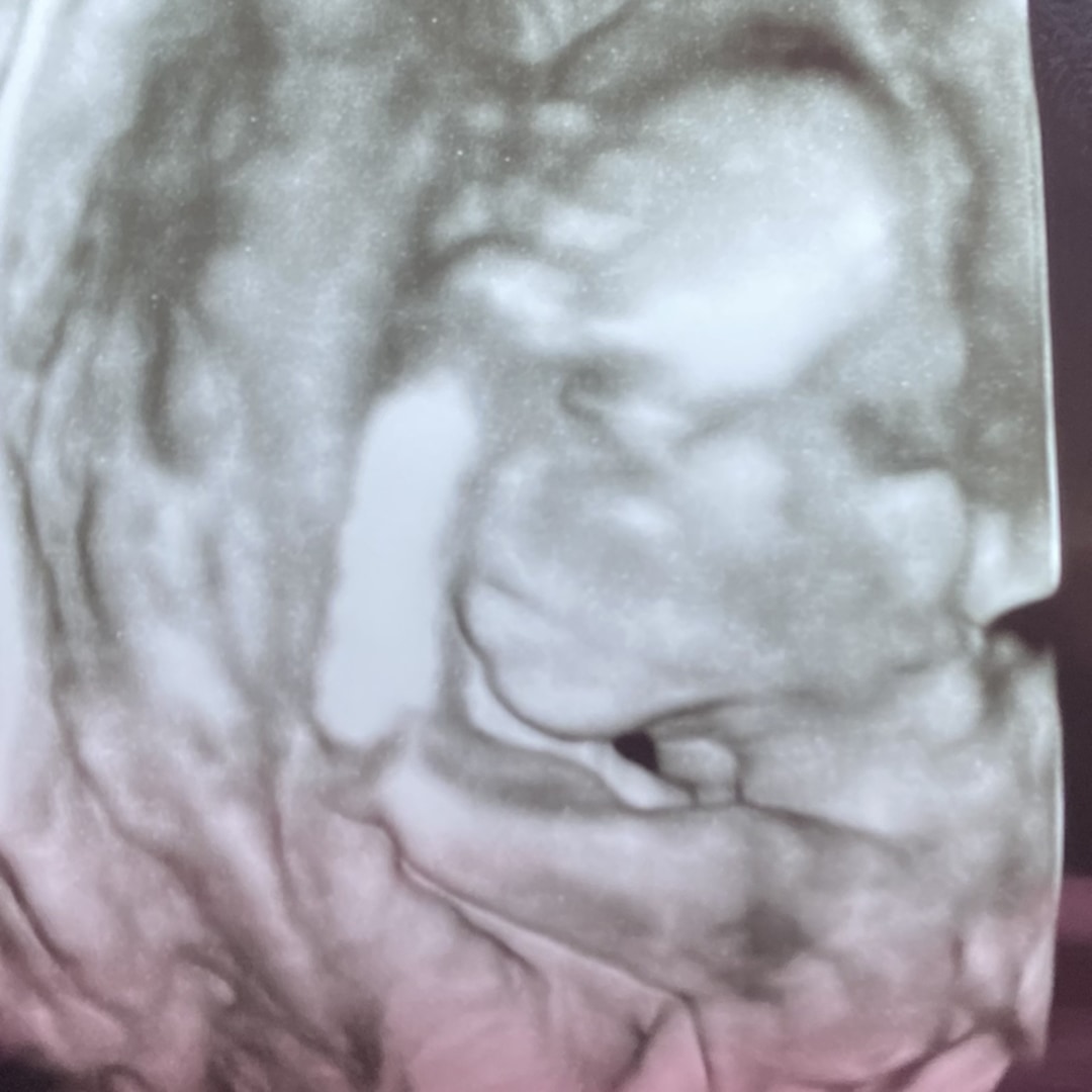Photo shared by Elena for their Babylist baby registry.
