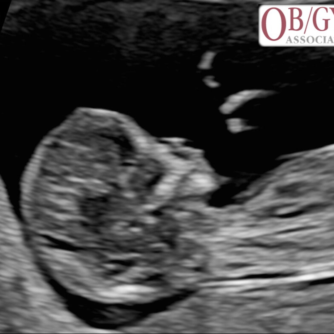 Photo shared by Isabelle for their Babylist baby registry.