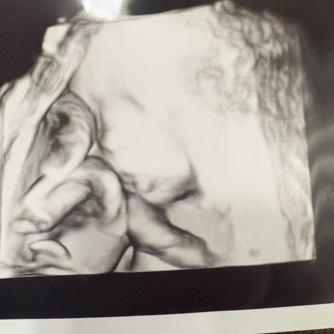 Photo shared by Anne for their Babylist baby registry.