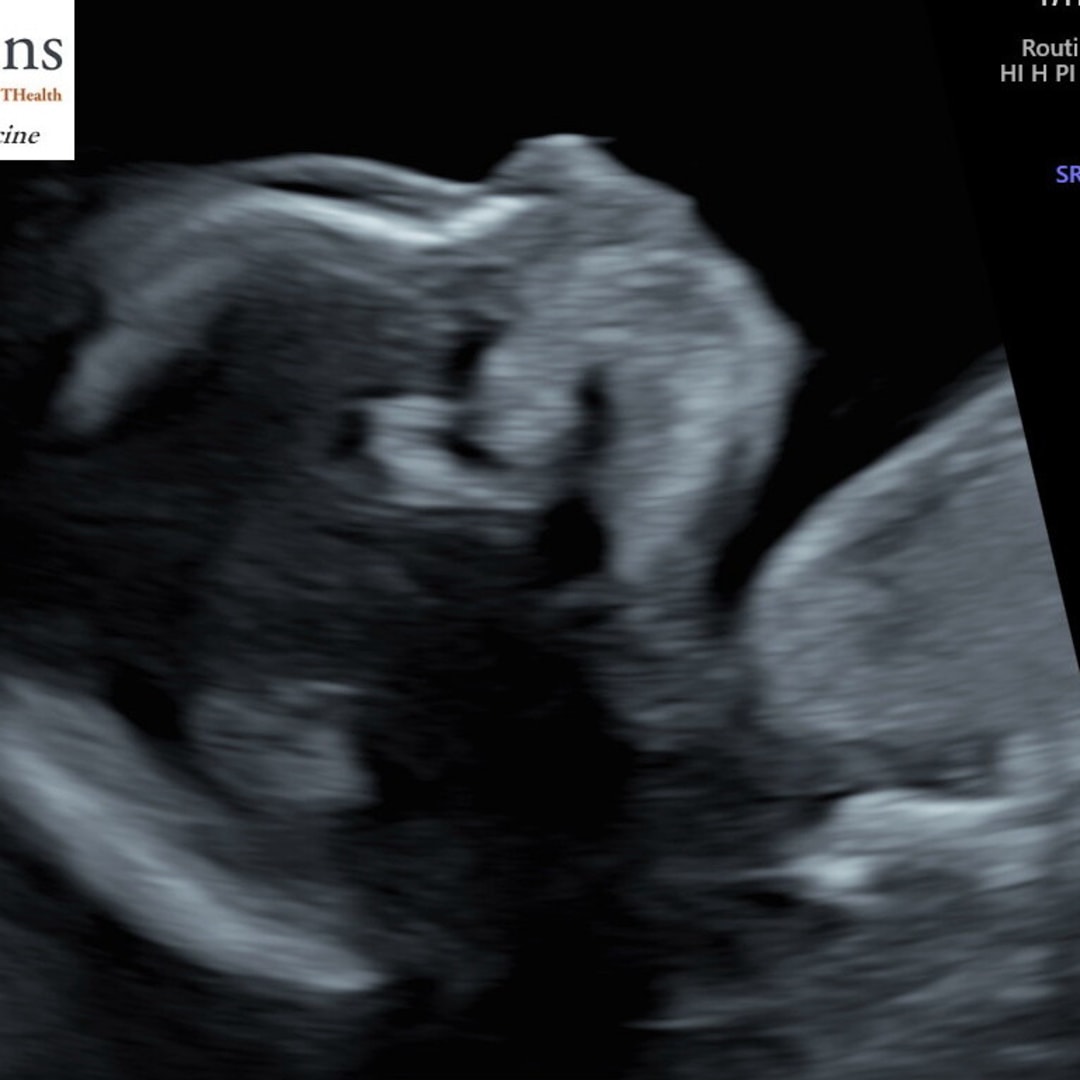 Photo shared by Megan for their Babylist baby registry.