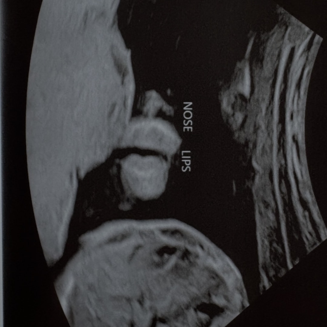 Photo shared by Aaliyah for their Babylist baby registry.