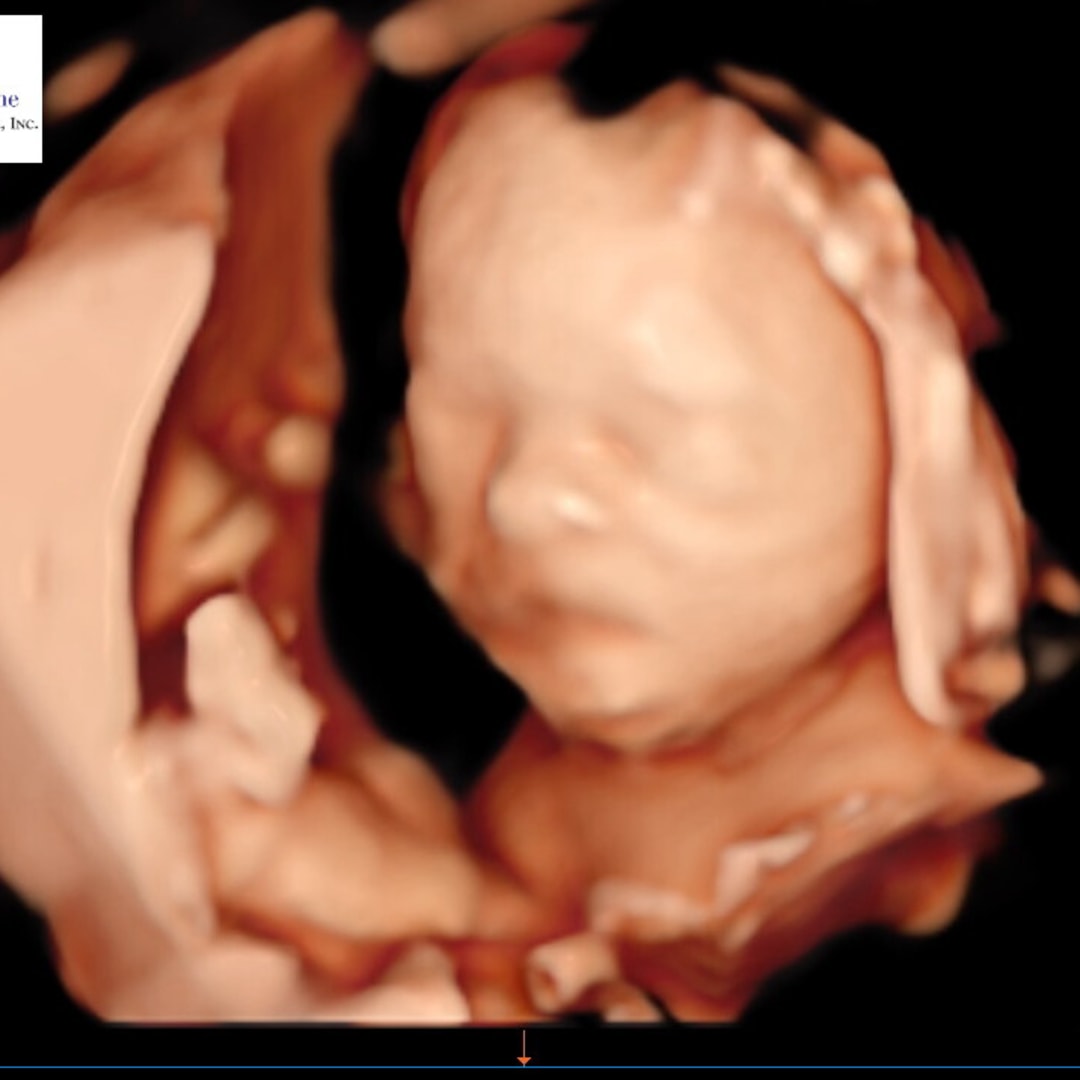 Photo shared by Dana for their Babylist baby registry.