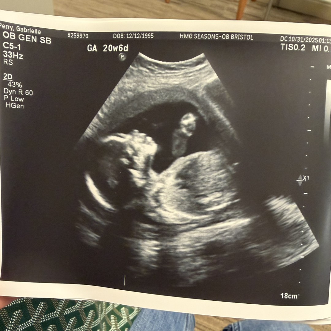 Photo shared by Gabrielle for their Babylist baby registry.