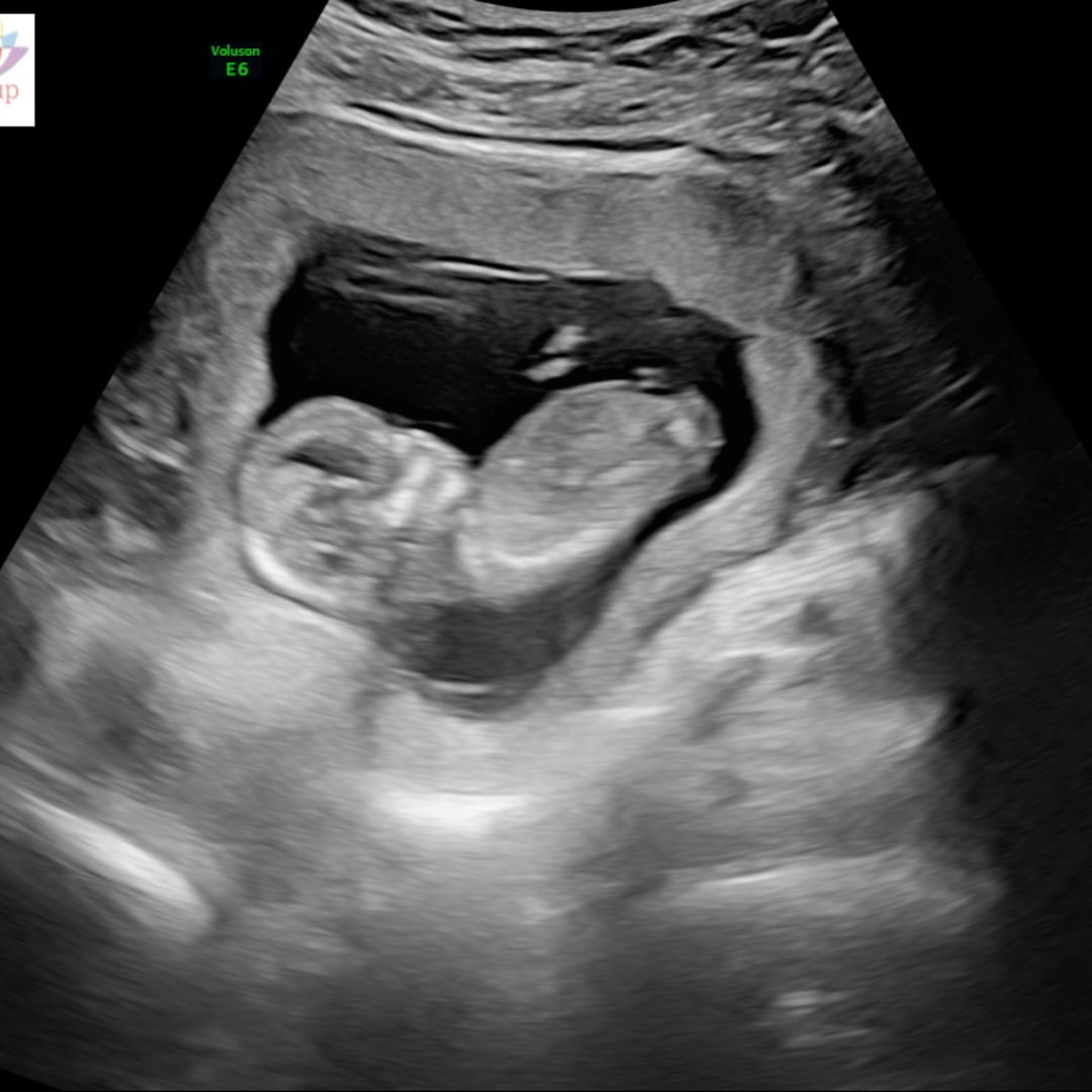 Photo shared by Lorey for their Babylist baby registry.