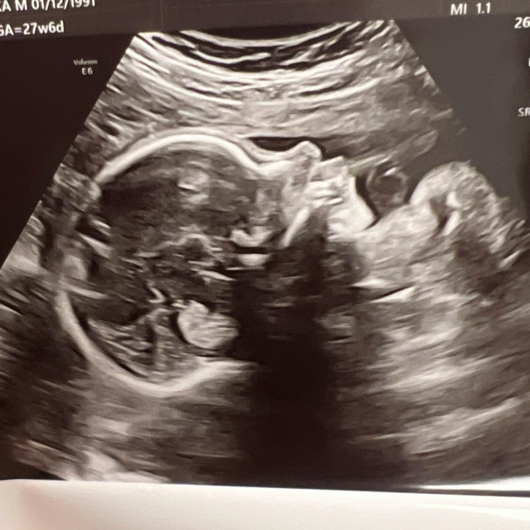 Photo shared by Neshka for their Babylist baby registry.