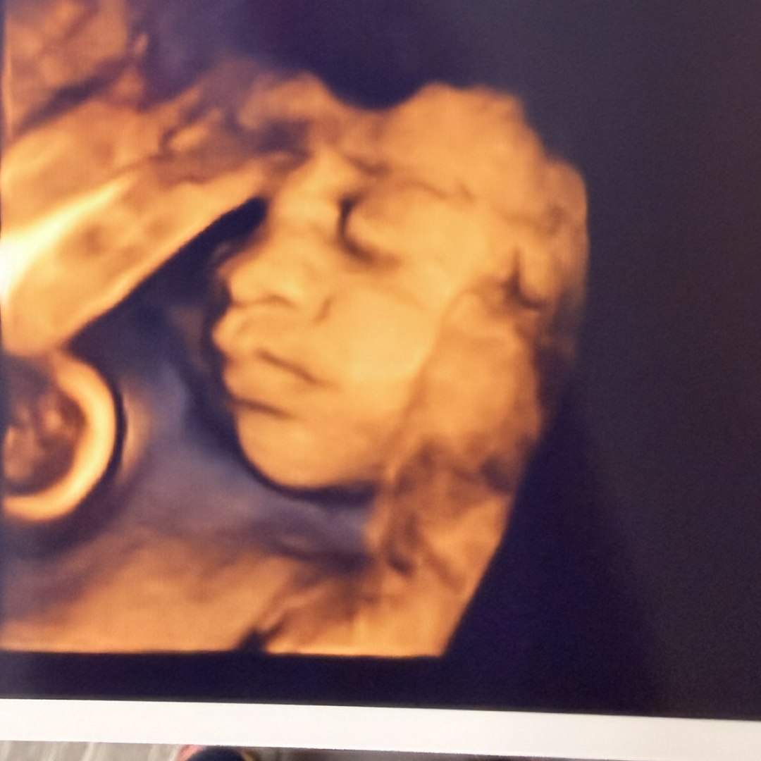 Photo shared by Chelsea for their Babylist baby registry.