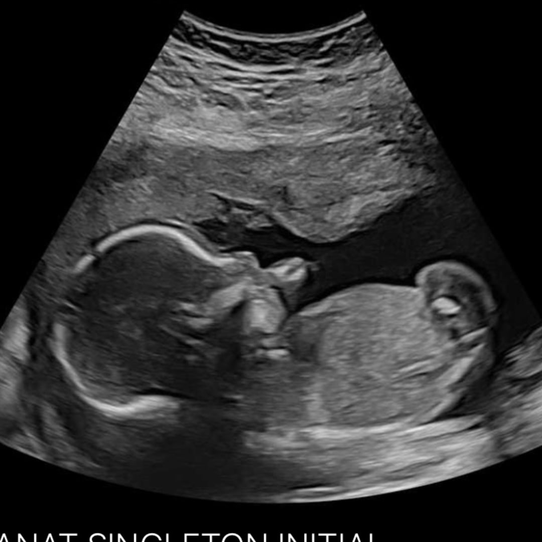 Photo shared by Dania for their Babylist baby registry.