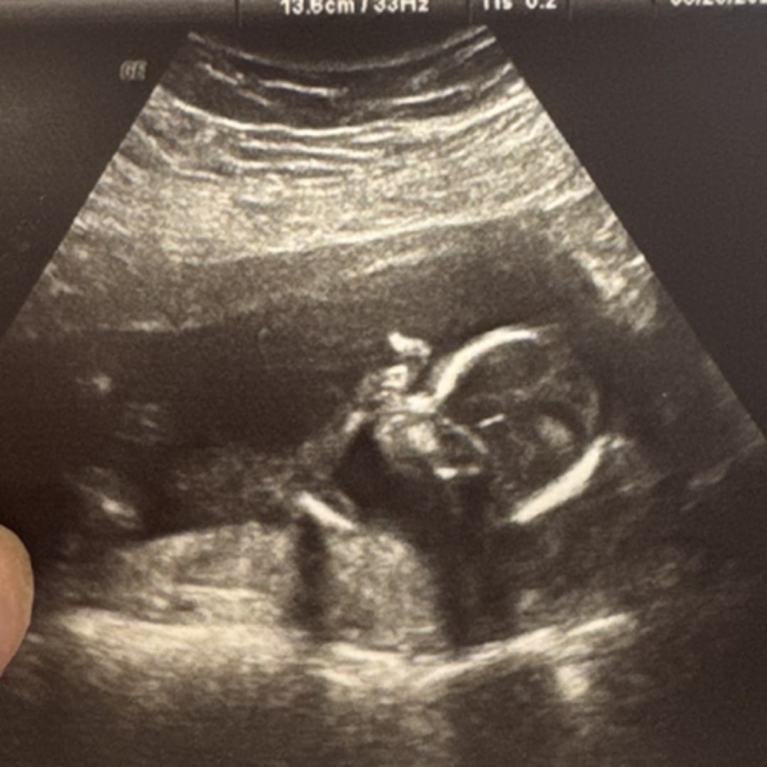 Photo shared by Guadalupe for their Babylist baby registry.