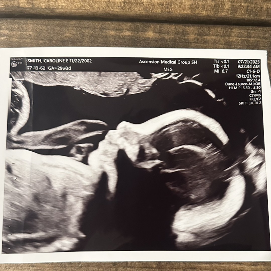 Photo shared by Caroline for their Babylist baby registry.
